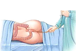 vasthi ayurvedic treatment in Habarana